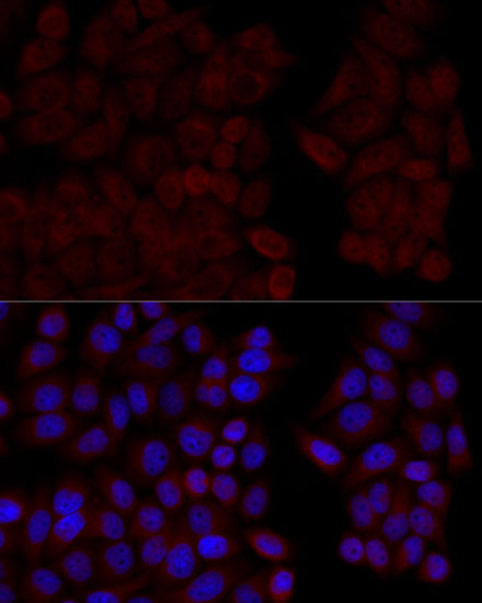 CALM1 Polyclonal Antibody (E-AB-66329)
