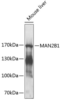 MAN2B1 Polyclonal Antibody (E-AB-93018)