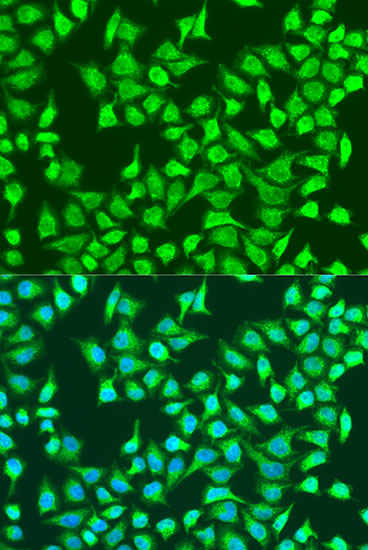 SIRT4 Polyclonal Antibody (E-AB-66582)