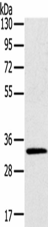 STK16 Polyclonal Antibody (E-AB-18292)