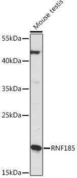RNF185 Polyclonal Antibody (E-AB-91452)