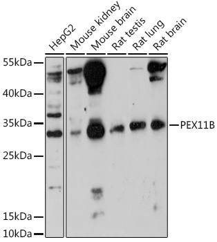 PEX11B Polyclonal Antibody (E-AB-92019)