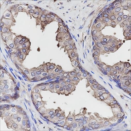 Recombinant Calpastatin Monoclonal Antibody (AN301454L)