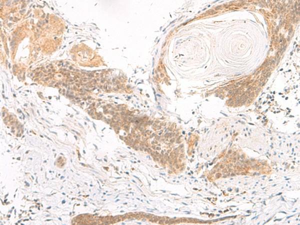 DGCR6L Polyclonal Antibody (E-AB-52856)