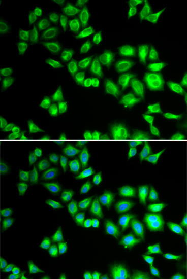 CUL1 Polyclonal Antibody (E-AB-60629)