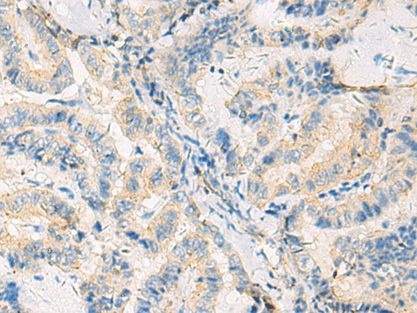 SYNGR1 Polyclonal Antibody (E-AB-52706)