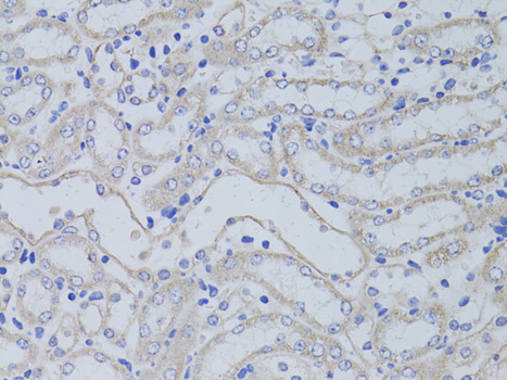 AQP5 Polyclonal Antibody (E-AB-66148)
