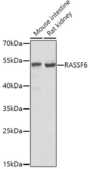 RASSF6 Polyclonal Antibody (E-AB-62579)