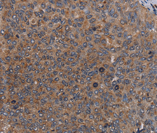 LIPE Polyclonal Antibody (E-AB-11314)