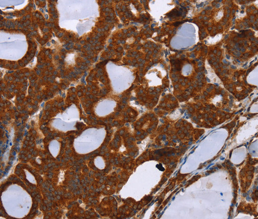 PPP2R3C Polyclonal Antibody (E-AB-11497)