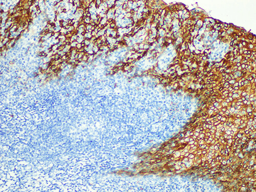 EMA Monoclonal Antibody (ELAB6052-M)