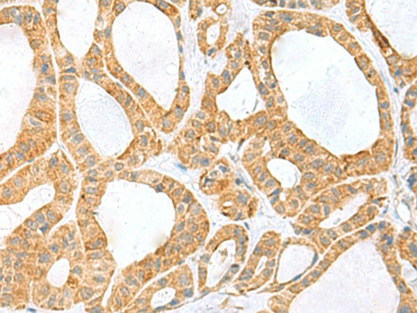 PPIH Polyclonal Antibody (E-AB-19147)