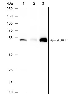 Recombinant ABAT Monoclonal Antibody (AN301692L)