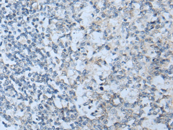 STARD4 Polyclonal Antibody (E-AB-53335)