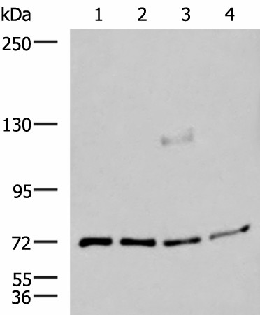 ASTE1 Polyclonal Antibody (E-AB-18975)