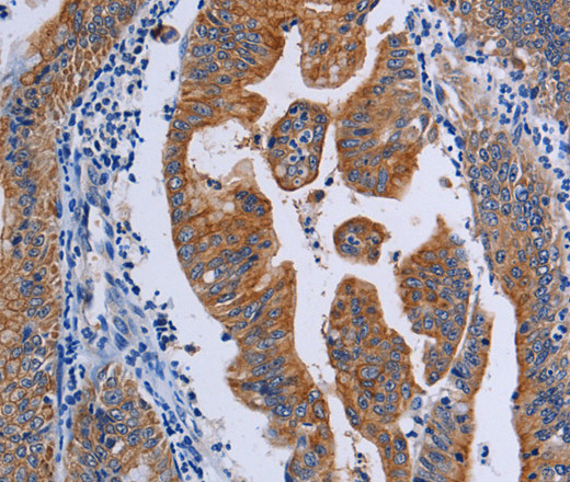 ACP6 Polyclonal Antibody (E-AB-11367)
