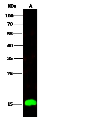 Recombinant C1D Monoclonal Antibody (AN300254P)