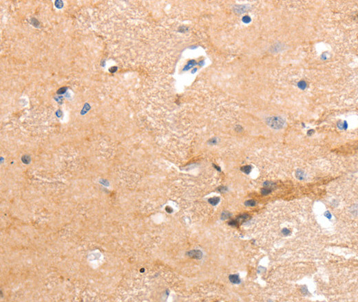 GPR64 Polyclonal Antibody (E-AB-12487)