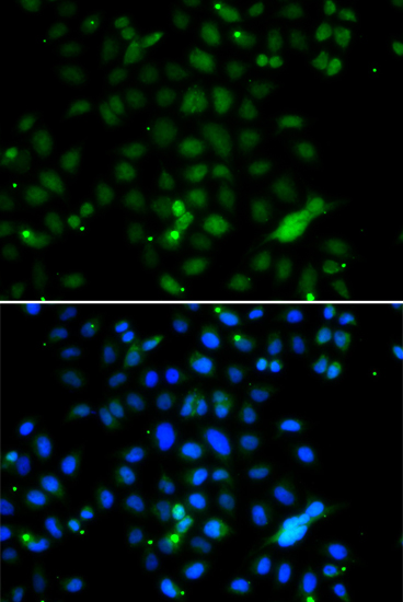 ELF4 Polyclonal Antibody (E-AB-61567)
