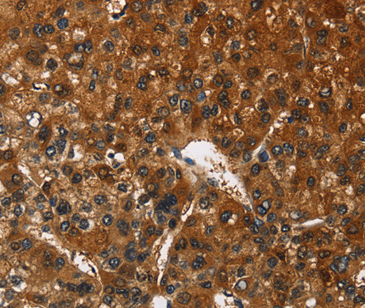 CATSPER4 Polyclonal Antibody (E-AB-14829)