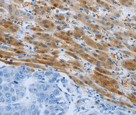 PSMD11 Polyclonal Antibody (E-AB-12850)