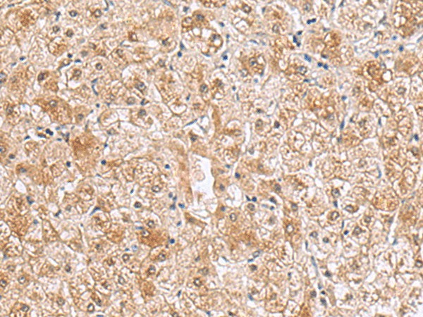 RTKN2 Polyclonal Antibody (E-AB-52895)