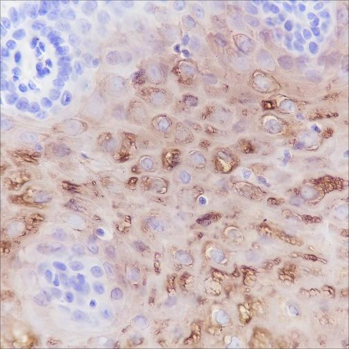 Recombinant Keratin 4 Monoclonal Antibody (AN301580L)