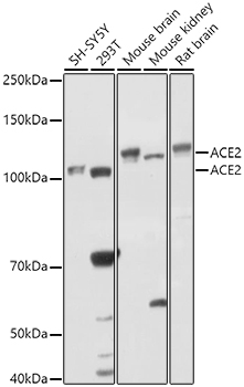 ACE2 Polyclonal Antibody (E-AB-93089)