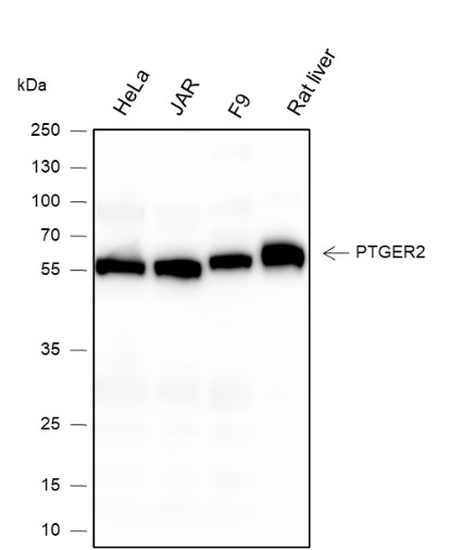 Recombinant PTGER2 Monoclonal Antibody (AN301641L)