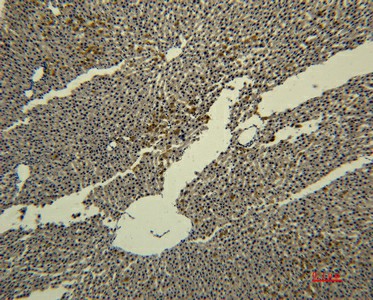 Transferrin Monoclonal Antibody (E-AB-22194)