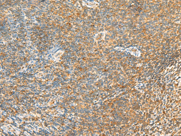 MTHFD2L Polyclonal Antibody (E-AB-18897)