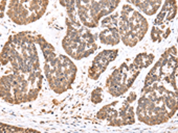 DDX58 Polyclonal Antibody (E-AB-19382)