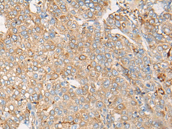 CAPN9 Polyclonal Antibody (E-AB-19659)