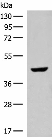 GNAT1 Polyclonal Antibody (E-AB-19919)