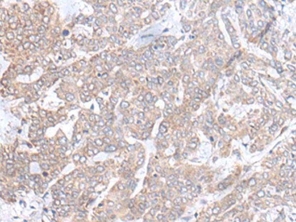 PLGLB2 Polyclonal Antibody (E-AB-18762)