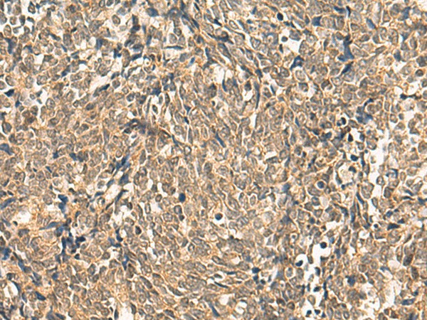 HNF1A Polyclonal Antibody (E-AB-19305)