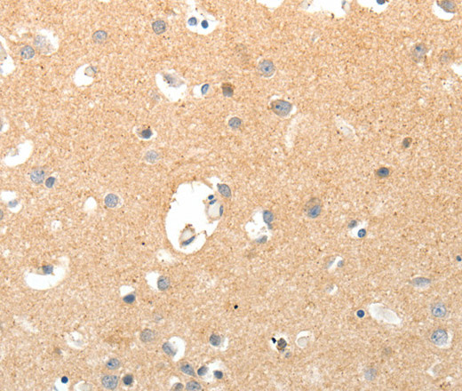 TNXB Polyclonal Antibody (E-AB-12899)