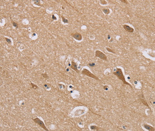 RAB6C Polyclonal Antibody (E-AB-13547)