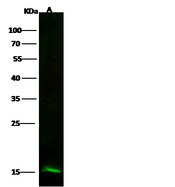 Recombinant Profilin 2/PFN2 Monoclonal Antibody (AN300277P)
