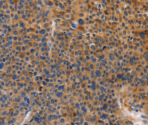 MUSK Polyclonal Antibody (E-AB-10909)