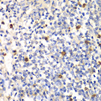 PSMD7 Polyclonal Antibody (E-AB-60920)
