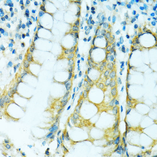 CYP2B6 Polyclonal Antibody (E-AB-63706)