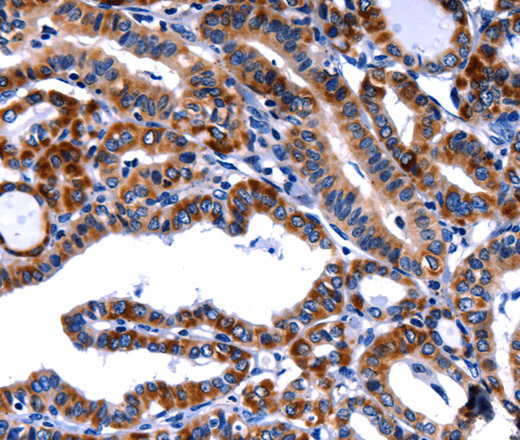 FBN1 Polyclonal Antibody (E-AB-12404)