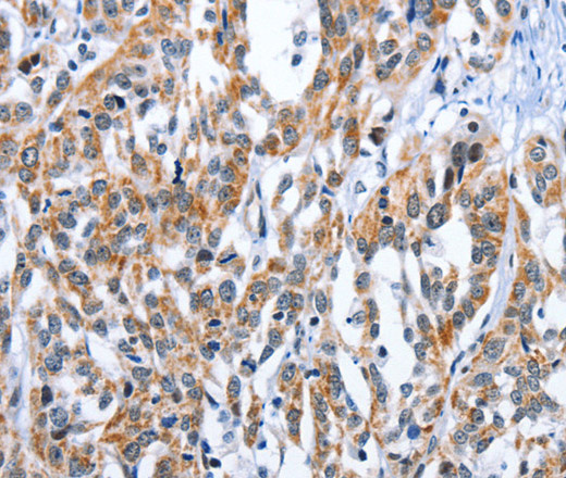 EDN3 Polyclonal Antibody (E-AB-10312)