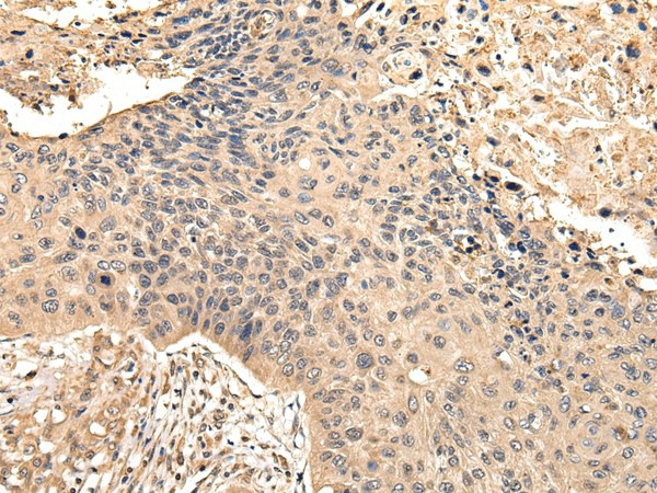 VPS35 Polyclonal Antibody (E-AB-17274)