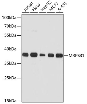 MRPS31 Polyclonal Antibody (E-AB-64377)