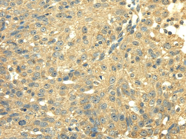SDHA Polyclonal Antibody (E-AB-17013)