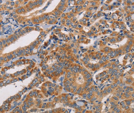CDK11A/B Polyclonal Antibody (E-AB-16328)
