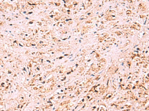 ZSWIM1 Polyclonal Antibody (E-AB-19048)