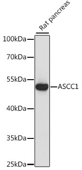 ASCC1 Polyclonal Antibody (E-AB-66600)